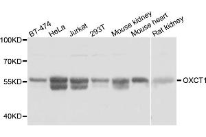 Western blot analysis of extracts of various cell lines, using OXCT1 antibody (ABIN5974499) at 1:3000 dilution. (OXCT1 Antikörper)