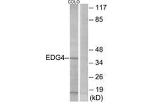 Western Blotting (WB) image for anti-Lysophosphatidic Acid Receptor 2 (LPAR2) (AA 290-339) antibody (ABIN2890765) (EDG4 Antikörper  (AA 290-339))