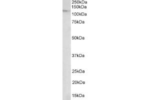 AP21281PU-N NUP107 antibody staining of Nuclear lysate of of NIH3T3 at 2 µg/ml (35µg protein in RIPA buffer). (NUP107 Antikörper  (Internal Region))