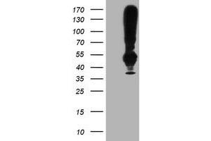 Western Blotting (WB) image for anti-Transmembrane Protein with EGF-Like and Two Follistatin-Like Domains 2 (TMEFF2) antibody (ABIN1501415) (TMEFF2 Antikörper)