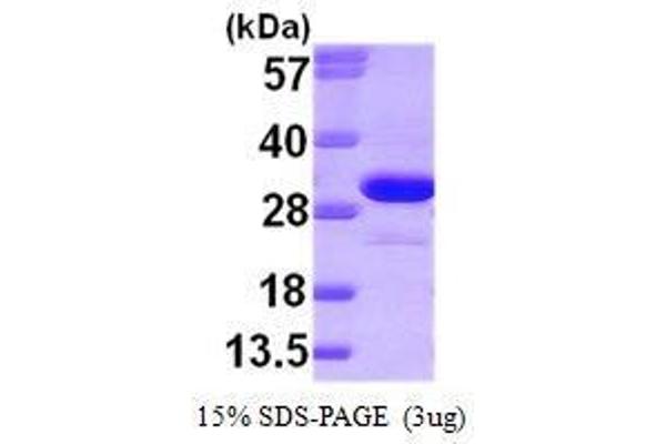 Ketohexokinase Protein (KHK) (AA 1-298)