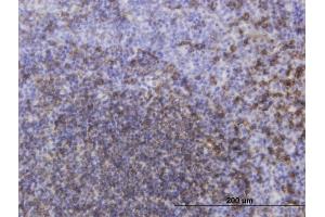 Immunoperoxidase of monoclonal antibody to MS4A1 on formalin-fixed paraffin-embedded human tonsil. (CD20 Antikörper  (AA 1-297))