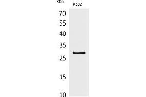 Western Blot analysis of K562 cells using CD58 Polyclonal Antibody. (CD58 Antikörper  (Internal Region))