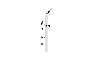 Western Blot at 1:1000 dilution + human uterus lysate Lysates/proteins at 20 ug per lane. (ZFP64 Antikörper  (C-Term))