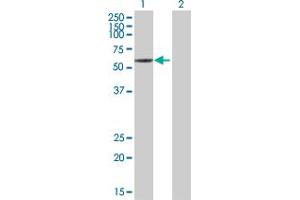 Western Blotting (WB) image for VMD2 293T Cell Transient Overexpression Lysate(Denatured) (ABIN1333890)