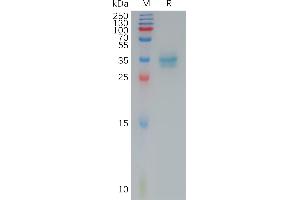 Claudin 4 Protein (CLDN4) (AA 145-157) (Fc Tag)