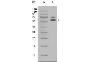 Western Blot showing CK5 antibody used against Hela cell lysate (1). (Cytokeratin 5 Antikörper)