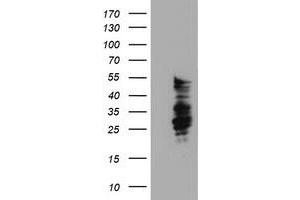 HEK293T cells were transfected with the pCMV6-ENTRY control (Left lane) or pCMV6-ENTRY SERPINB2 (Right lane) cDNA for 48 hrs and lysed. (SERPINB2 Antikörper)