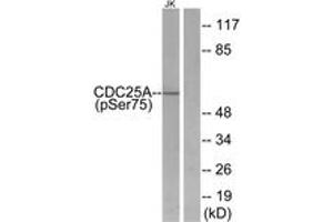 Western blot analysis of extracts from Jurkat cells treated with UV, using CDC25A (Phospho-Ser75) Antibody. (CDC25A Antikörper  (pSer76))