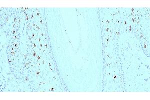 Human skin: immunohistochemical staining for langerin. (CD207 Antikörper)