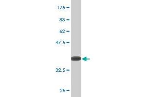 Western Blot detection against Immunogen (36. (ZBTB16 Antikörper  (AA 381-480))