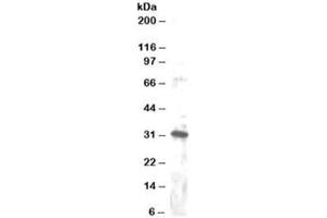 Western blot testing of Jurkat lysate with DKK4 antibody at 1ug/ml. (DKK4 Antikörper)