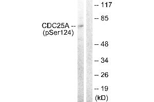 Western blot analysis of extracts from 293 cells, treated with UV (15mins), using CDC25A (Phospho-Ser124) antibody. (CDC25A Antikörper  (pSer124))