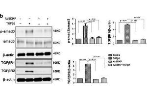 Western Blotting (WB) image for anti-SMAD, Mothers Against DPP Homolog 3 (SMAD3) (AA 417-425), (pSer423), (pSer425) antibody (ABIN129675)