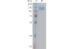 Human I Protein, hFc Tag on SDS-PAGE under reducing condition. (Integrin beta 5 Protein (ITGB5) (AA 24-719) (Fc Tag))