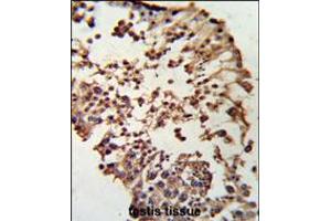 Formalin-fixed and paraffin-embedded human testis tissue reacted with RB1 Antibody , which was peroxidase-conjugated to the secondary antibody, followed by DAB staining. (Retinoblastoma 1 Antikörper  (C-Term))