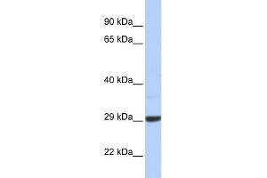 WB Suggested Anti-C10orf56 Antibody Titration: 0. (ZCCHC24 Antikörper  (Middle Region))