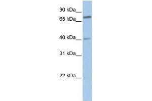 SSX2IP antibody used at 1 ug/ml to detect target protein. (SSX2IP Antikörper  (Middle Region))