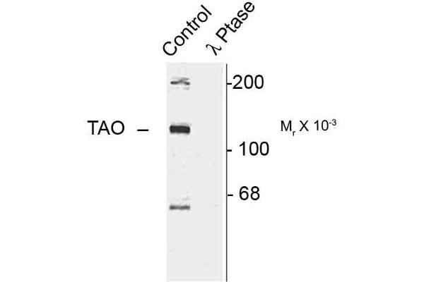 TAO Kinase 2 Antikörper  (pSer181)