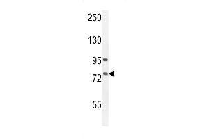 ALOX12B Antikörper  (C-Term)