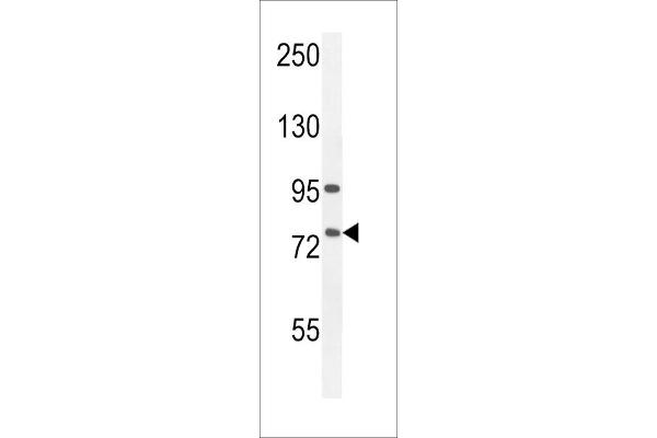 ALOX12B Antikörper  (C-Term)