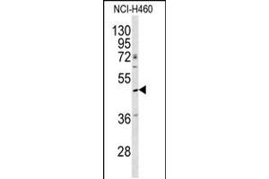 Western blot analysis of SERPINA4 antibody in NCI-H460 cell line lysates (35ug/lane) (SERPINA4 Antikörper  (C-Term))
