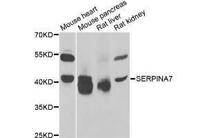 Western blot analysis of extracts of various cell lines, using SERPINA7 antibody. (SERPINA7 Antikörper)