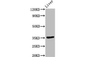 Western Blot Positive WB detected in: Rat liver tissue All lanes: EPCAM antibody at 9. (EpCAM Antikörper  (AA 24-265))