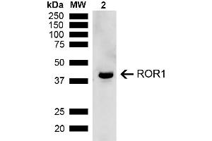 Western blot analysis of Rat Kidney showing detection of ~43 kDa ROR1 protein using Rabbit Anti-ROR1 Polyclonal Antibody (ABIN5667778). (ROR1 Antikörper  (AA 200-300) (APC))