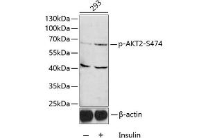 Western blot analysis of extracts of 293 cells, using Phospho--S474 antibody (ABIN3023507, ABIN3023508, ABIN3023509 and ABIN6225357) 1:1000 dilution. (AKT2 Antikörper  (pSer474))