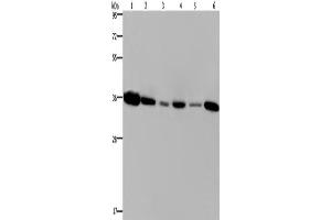 Western Blotting (WB) image for anti-Emerin (EMD) antibody (ABIN2423376) (Emerin Antikörper)