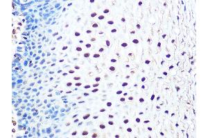 Immunohistochemistry of paraffin-embedded human esophageal using THOC4/THOC4/ALYREFREF Rabbit mAb (ABIN1679512, ABIN3018793, ABIN3018794 and ABIN7101662) at dilution of 1:100 (40x lens). (THO Complex 4 Antikörper)