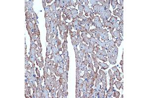 Immunohistochemistry of paraffin-embedded rat heart using CDC42EP1 Rabbit mAb (ABIN7266231) at dilution of 1:100 (40x lens). (CDC42EP1 Antikörper)