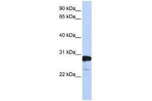WB Suggested Anti-RANBP1 Antibody Titration:  0. (RANBP1 Antikörper  (C-Term))