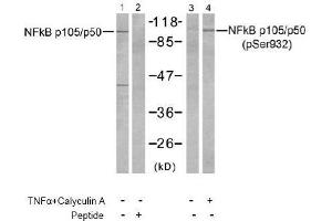Image no. 2 for anti-Nuclear Factor of kappa Light Polypeptide Gene Enhancer in B-Cells 1 (NFKB1) (Ser932) antibody (ABIN197494) (NFKB1 Antikörper  (Ser932))