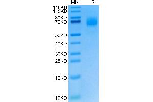 Cynomolgus IL-23R on Tris-Bis PAGE under reduced condition. (IL23R Protein (AA 24-353) (His tag))