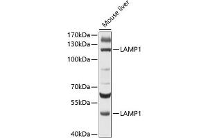 Western blot analysis of extracts of mouse liver, using L antibody (ABIN6130048, ABIN6143079, ABIN6143080 and ABIN6215226) at 1:500 dilution. (LAMP1 Antikörper  (AA 80-280))