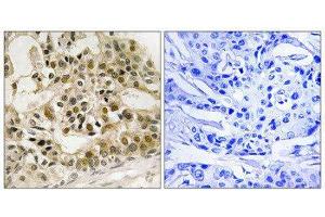 Immunohistochemistry (IHC) image for anti-V-Myb Myeloblastosis Viral Oncogene Homolog (Avian) (MYB) (pSer532) antibody (ABIN1847796) (MYB Antikörper  (pSer532))