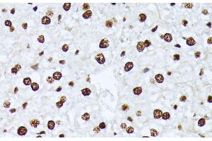 Immunohistochemistry of paraffin-embedded Mouse liver using Phospho-ATF2(T69/T71) Polyclonal Antibody at dilution of 1:100 (40x lens). (ATF2 Antikörper  (pThr69, pThr71))