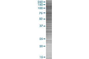 HIRA transfected lysate. (HIRA 293T Cell Transient Overexpression Lysate(Denatured))