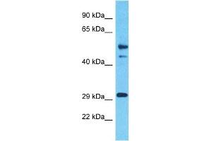 Host:  Rabbit  Target Name:  ZNF514  Sample Type:  Thymus Tumor lysates  Antibody Dilution:  1. (ZNF514 Antikörper  (Middle Region))