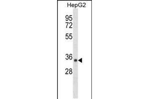 Western blot analysis in HepG2 cell line lysates (35ug/lane). (SDR39U1 Antikörper  (N-Term))