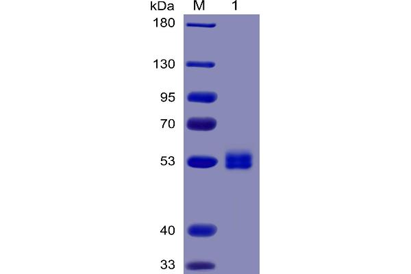 IL-6 Protein (AA 30-212) (mFc-His Tag)