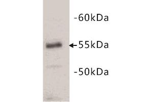 Western Blotting (WB) image for anti-CD4 (CD4) antibody (ABIN1854860) (CD4 Antikörper)