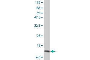 Western Blot detection against Immunogen (15. (IL-2 Antikörper  (AA 21-153))