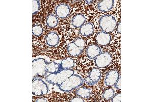 Immunohistochemistry (Paraffin-embedded Sections) (IHC (p)) image for anti-Vimentin (VIM) antibody (ABIN1881993)