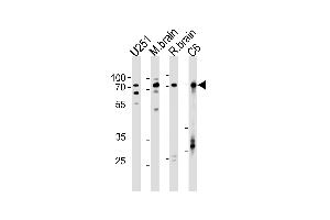 Western blot analysis in U251,rat C6 cell line,mouse brain,rat brain tissue lysates (35ug/lane). (FUBP1 Antikörper  (AA 240-268))