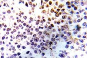 Immunohistochemistry (IHC) analyzes of Histone H3. (Histone H3.1 Antikörper)