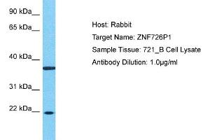 Host: Rabbit Target Name: ZNF726P1 Sample Type: 721_B Whole Cell lysates Antibody Dilution: 1. (ZNF726P1 Antikörper  (N-Term))