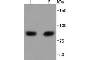 Lane 1: MCF-7, Lane 2: Raji lysate probed with PI 3 Kinase p85 alpha (2G4) Monoclonal Antibody  at 1:1000 overnight at 4˚C. (PIK3R1 Antikörper)